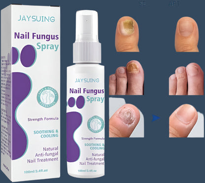 Gentle Nail Fungus Remover Maxum